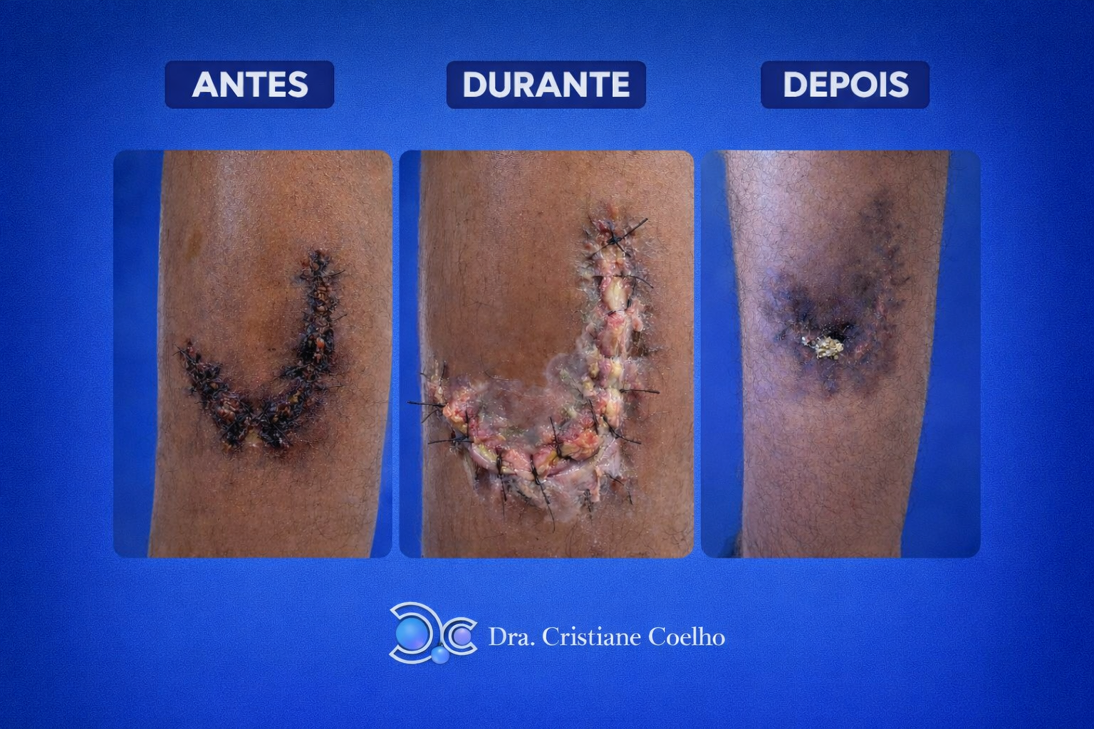 Antes, durante e depois do tratamento